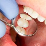 Preventive Dentistry: Why Dental Arts of Frisco is the Best Dentist in Frisco, Texas, for Your Oral Health_FI